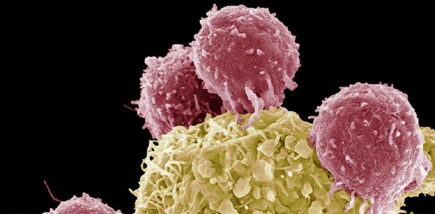 reduciendo la incidencia de mortalidad en el Cáncer familiar