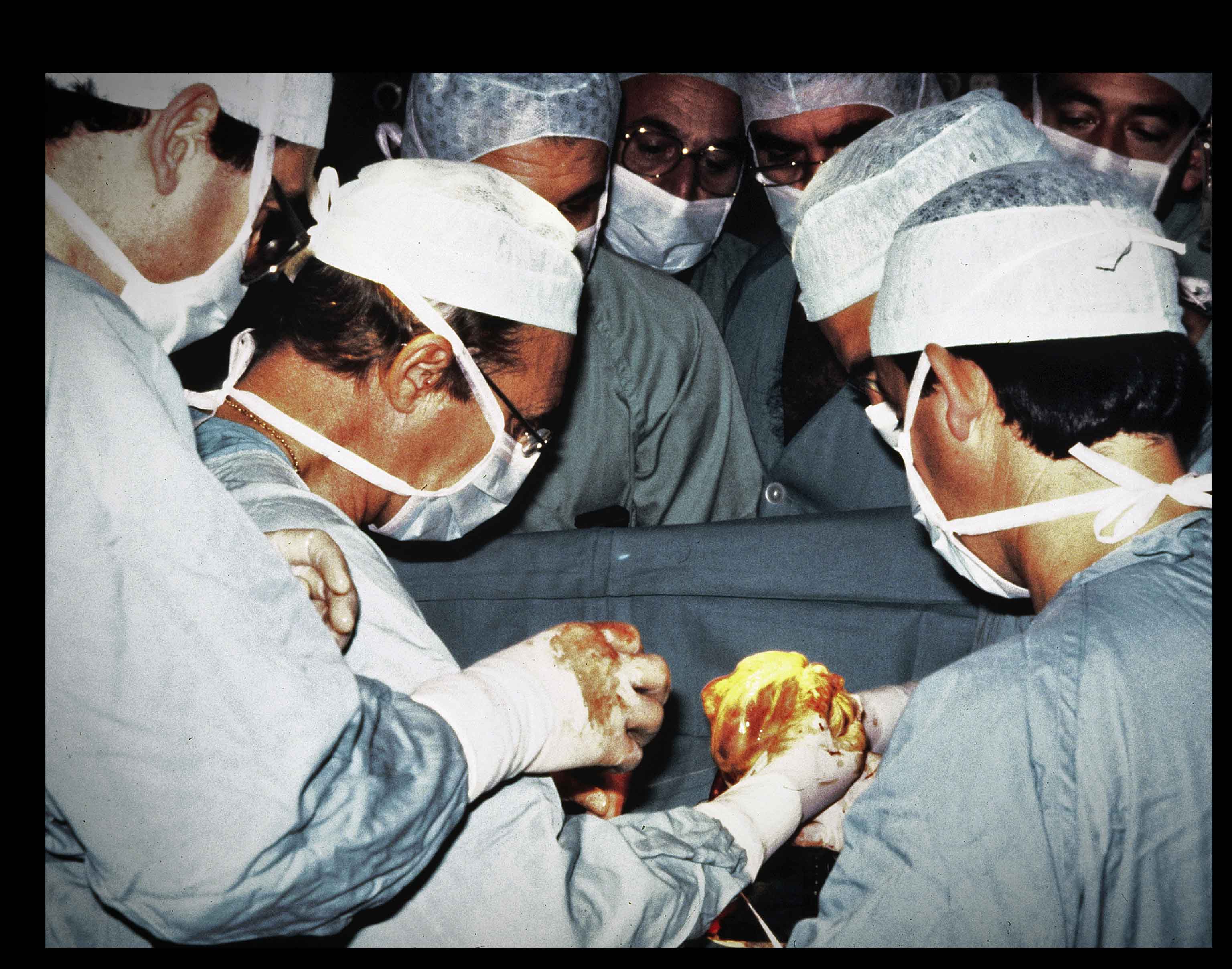 Imagen del primer trasplante de corazón realizado en el Hospital La Fe de Valencia