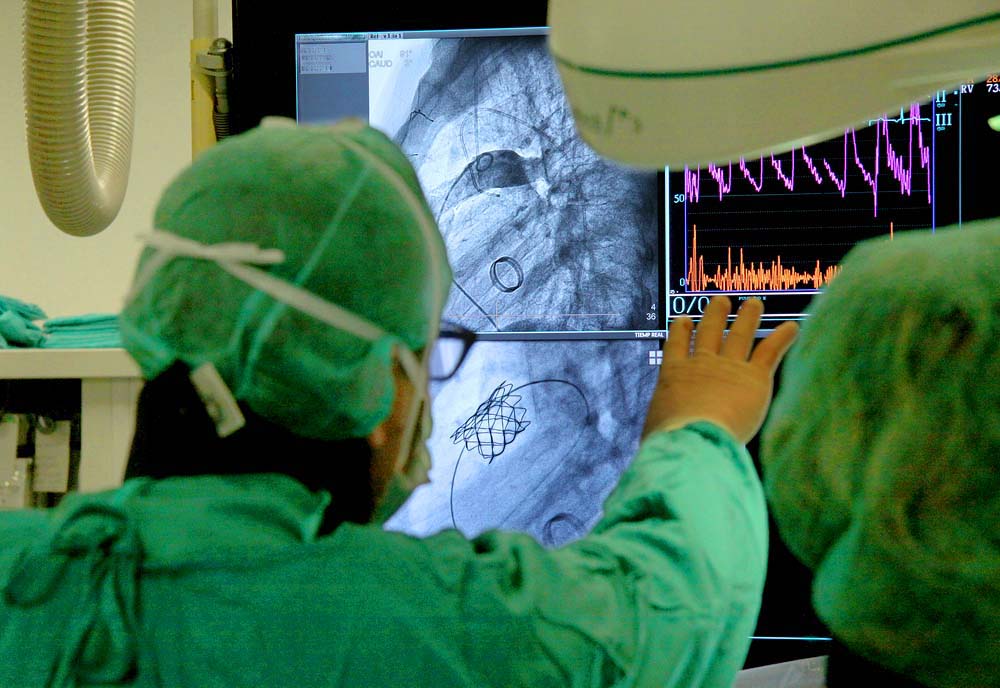 Válvula Pulmonar 